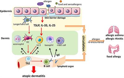 Research Progress in Atopic March